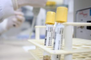 Jaraguá do Sul confirma mais duas mortes por coronavírus e chega a 55 óbitos